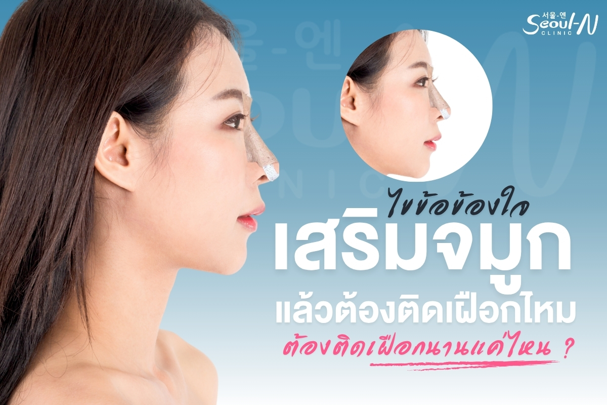 ต้องติดเฝือกนานแค่ไหน